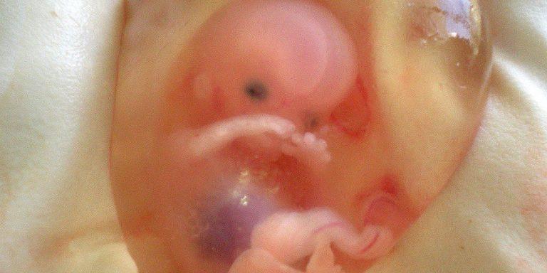 Pentagon Still Funding Biden-era Fetal Research on Animals