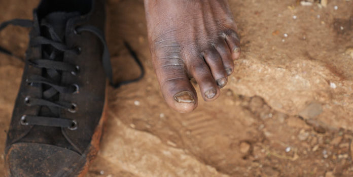 Street vendors take off their shoes./ PHOTO: Associated Press